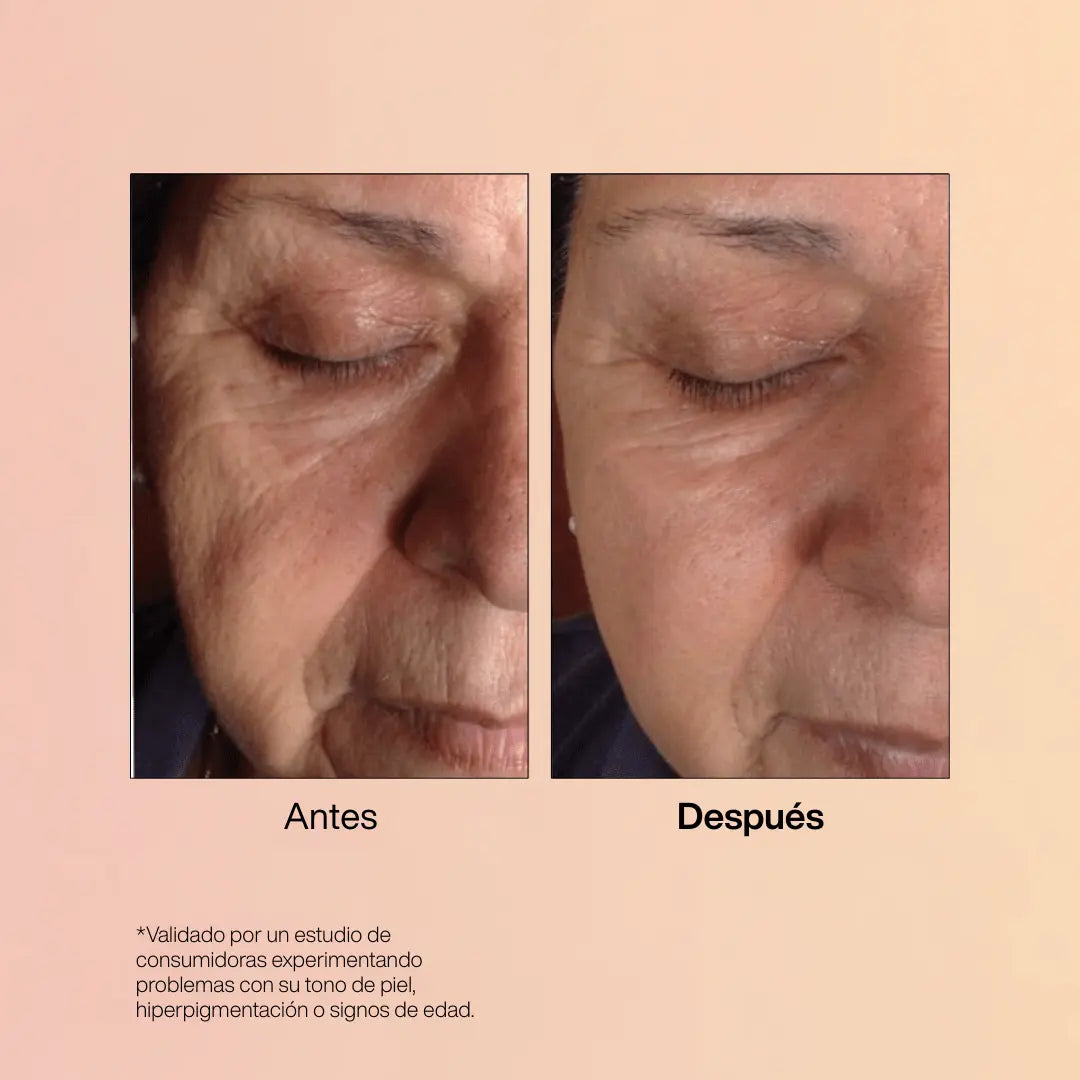 NutriSkin™ - Mi tienda